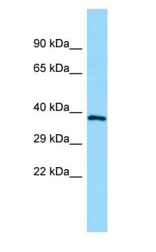 Polyclonal Rabbit anti-Human GPR160 Antibody (aa226-275, WB)