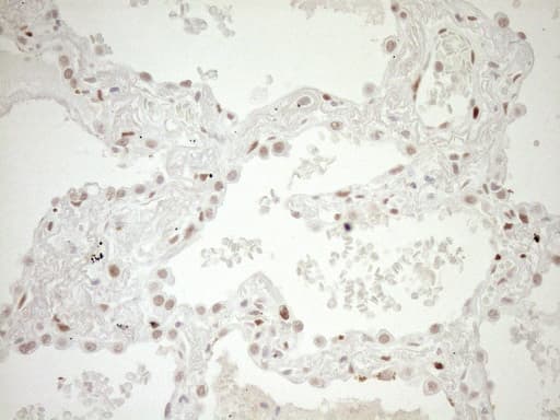 NR1H3 / LXR Alpha Antibody (aa69-329, clone OTI1A5)