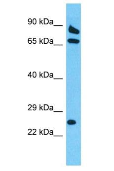 Polyclonal Rabbit anti-Human DSCR3 Antibody (aa95-144, WB)