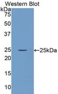 LAMA4 / Laminin Alpha 4 Antibody (aa832-1039)