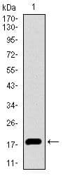 Monoclonal Mouse anti-Human ID2 Antibody (clone 4E12G5, Amino Acid: 1-134, IHC, WB)