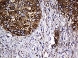 HSPD1 / HSP60 Antibody (clone OTI6F7)