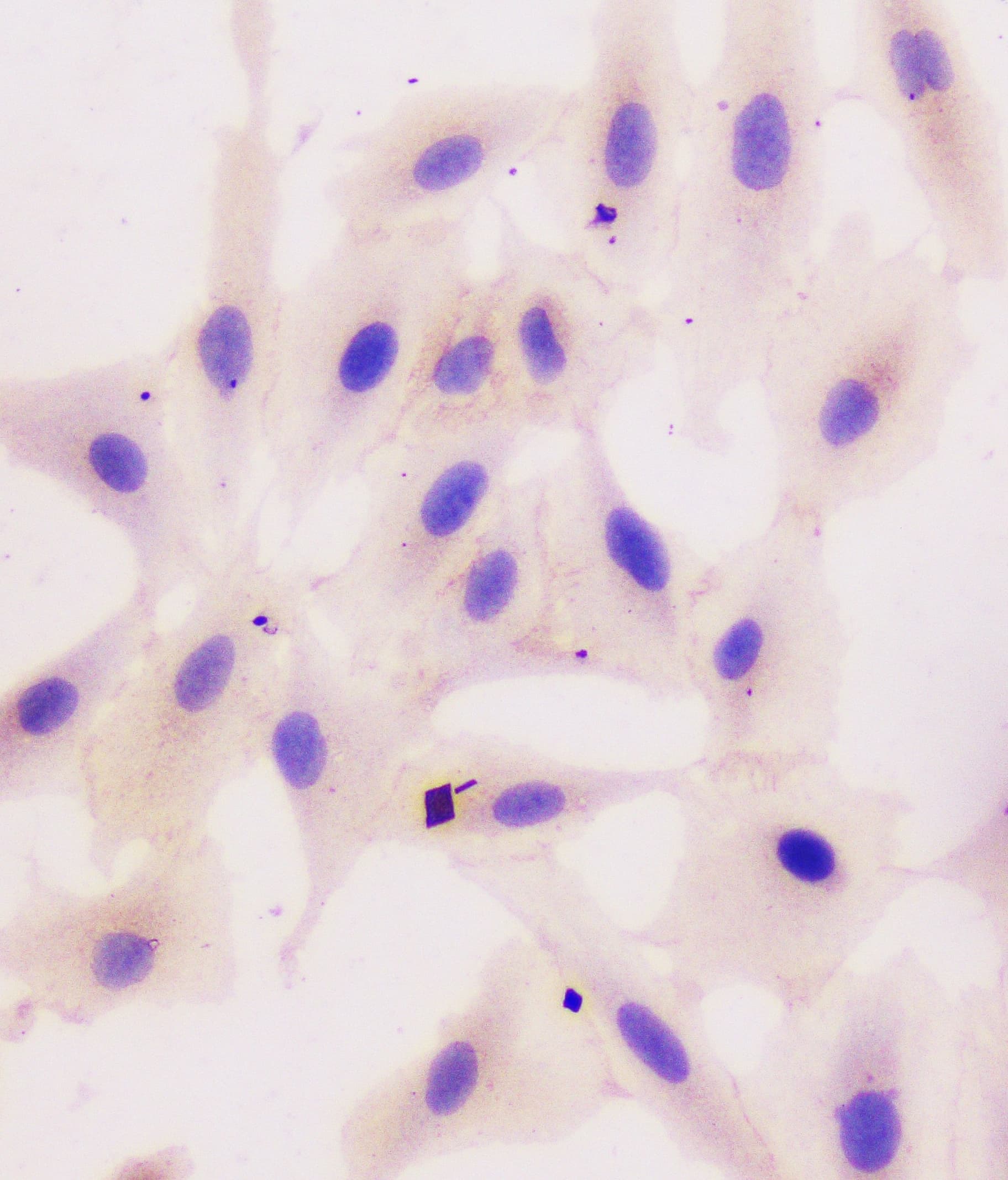 CTNNB1 / Beta Catenin Antibody