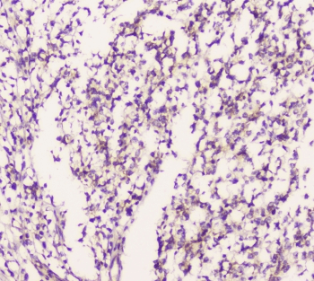 EML4 Antibody