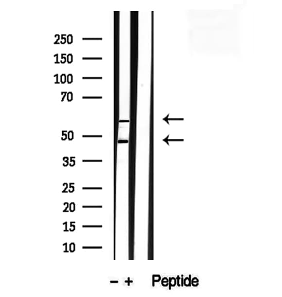 Polyclonal Rabbit anti-Human SEPT9 / Septin 9 Antibody (IHC, IF, WB)