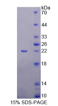 Human SHBG Protein (Recombinant His-T7)