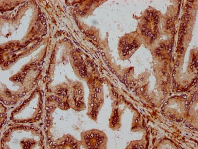 Polyclonal Rabbit anti-Human PPA2 Antibody (IHC, WB)