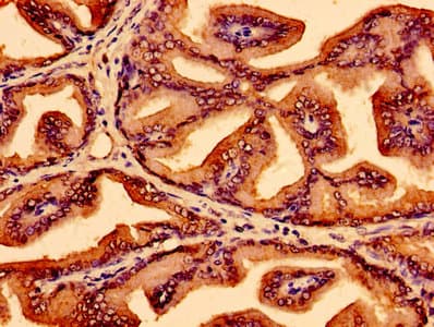 Polyclonal Rabbit anti-Human LSM1 Antibody
