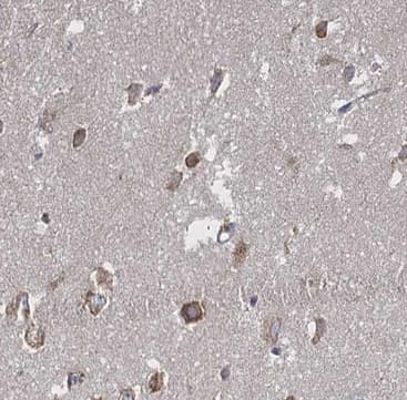 PIAS3 Antibody