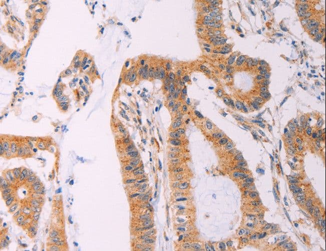 ADCY1 / Adenylate Cyclase 1 Antibody