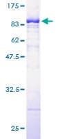 Human PKM / Pyruvate Kinase, Muscle Protein (Recombinant GST)