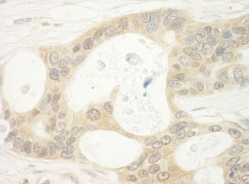 IHC-plus™ FLCN / Folliculin Antibody (aa1-50)