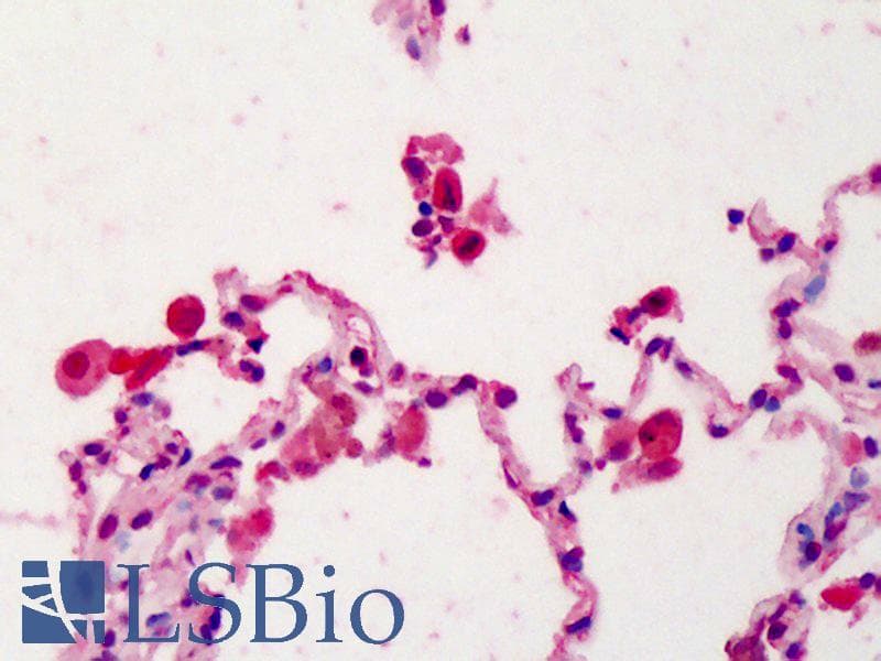 IHC-plus™ IL22RA1 / IL22R Antibody