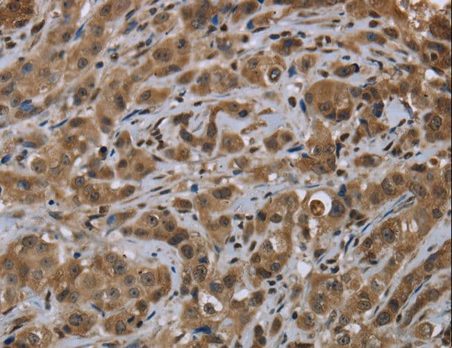 FTO Antibody