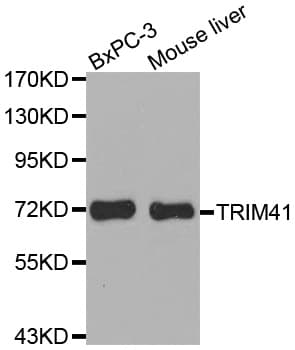 Polyclonal Rabbit anti-Human TRIM41 Antibody (WB)