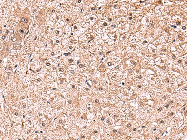 RUSC1 Antibody