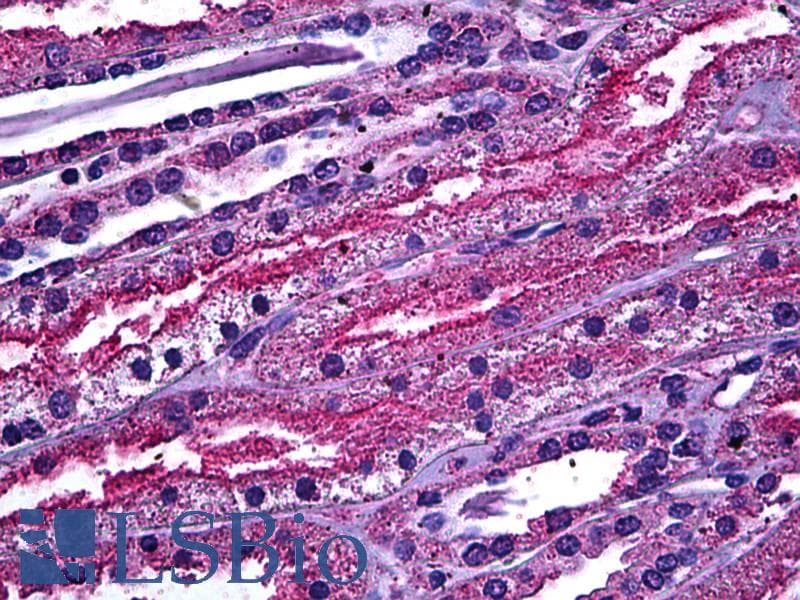 IHC-plus™ ABCC4 / MRP4 Antibody (clone 1B2)