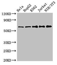 Polyclonal Rabbit anti-Human CPSF6 Antibody (IHC, IF, WB)
