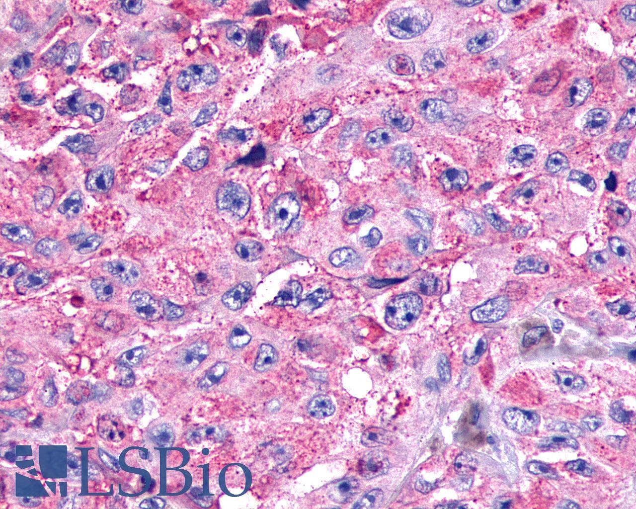 PathPlus™ SSTR1 Antibody (N-Terminus)