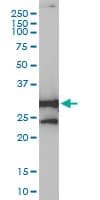 NQO1 Antibody (clone 1E3-A6)