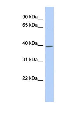 TMCC1 Antibody (aa215-264)