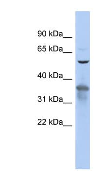 RAB3IP / RABIN3 Antibody (aa35-84)