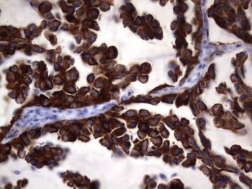 Monoclonal Mouse anti-Human KRT19 / CK19 / Cytokeratin 19 Antibody (clone OTI6E8, aa240-390, IHC)
