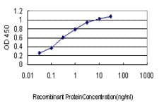 IHC-plus™ NMI Antibody (clone 9D8)