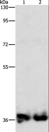 Polyclonal Rabbit anti-Human ASPA Antibody (IHC, WB)