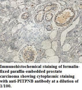 PITPNB Antibody (aa20-261)