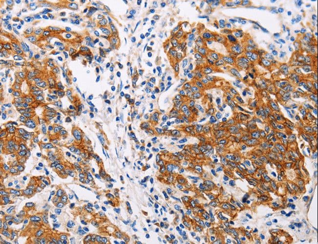 CTNNA1 / Catenin Alpha-1 Antibody