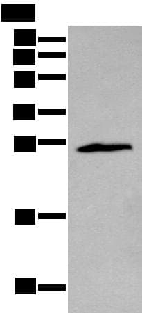 ZNF22 Antibody