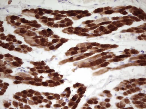 TNNI1 Antibody (clone OTI8H8)