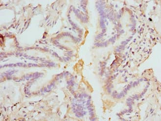 Polyclonal Rabbit anti-Human FCN1 / Ficolin-1 Antibody (IHC)