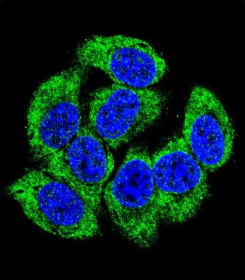 Polyclonal Rabbit anti-Human GCLM Antibody (aa246-274, IHC, IF, WB)