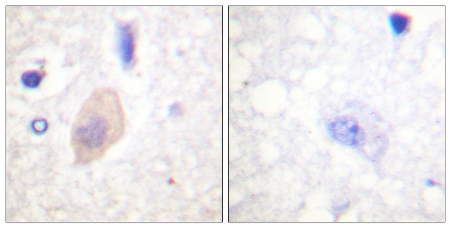 Polyclonal Rabbit anti-Human CDC25B Antibody (phospho-Ser353, IHC, WB)