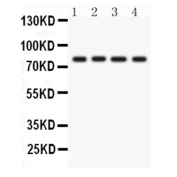 PRKCH / PKC-Eta Antibody (aa30-389)