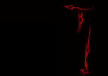 SPON2 / MINDIN Antibody