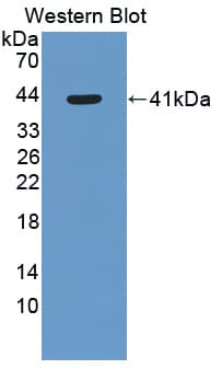 HSD2 / HSD11B2 Antibody (aa58-393)