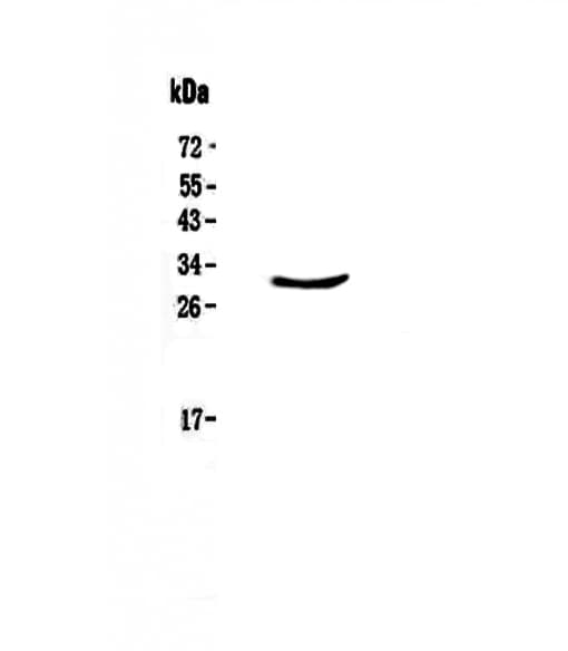 CLPP Antibody