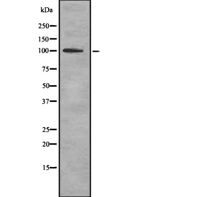 TPO / Thyroid Peroxidase Antibody