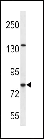 CPT1B Antibody (aa744-770)