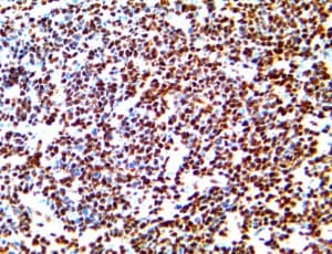 LMO2 Antibody (clone RBT-LM02)