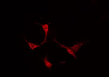 TROP2 / TACSTD2 Antibody