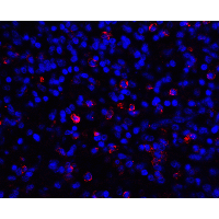 CD276 / B7-H3 Antibody