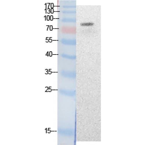 KAT2B / PCAF Antibody (around the acetylation site of K428.)