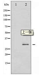SNAI1 / SNAIL-1 Antibody