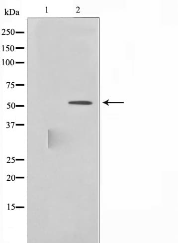 LYN Antibody