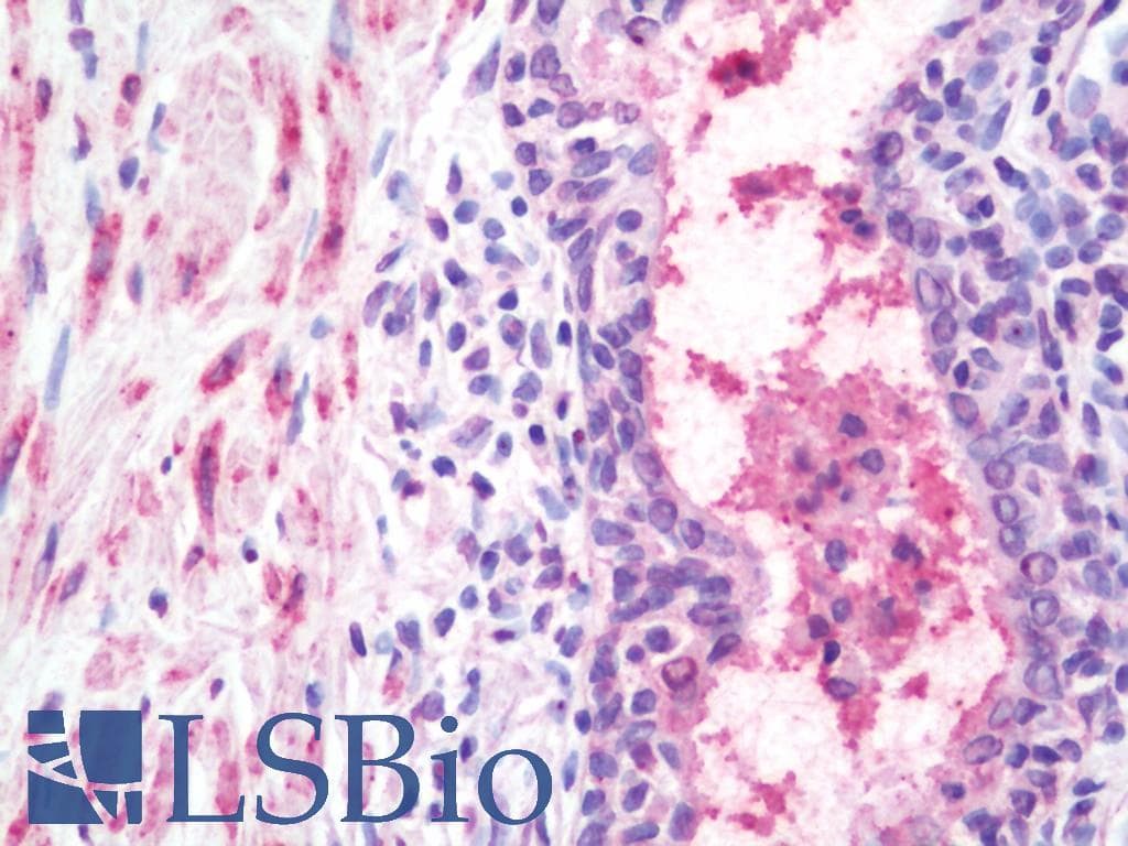 IHC-plus™ WNT10A Antibody (Internal)