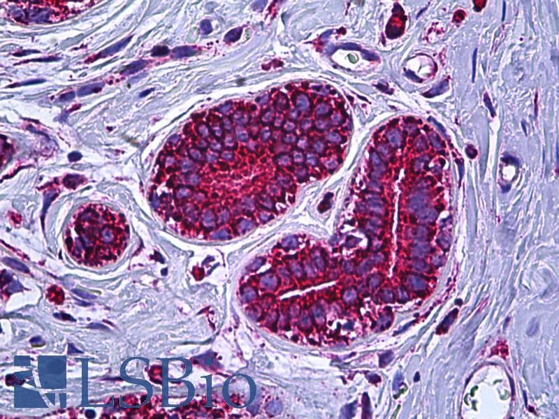 IHC-plus™ ATP5A1 / ATP Synthase Alpha Antibody (aa201-250)